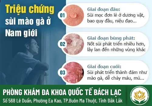 Sùi mào gà